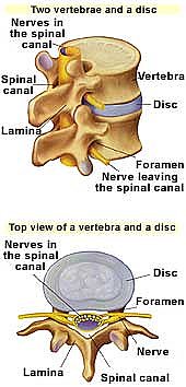 lumbar discs